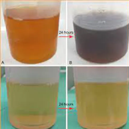 Alkaptonuria Urine Quantitative